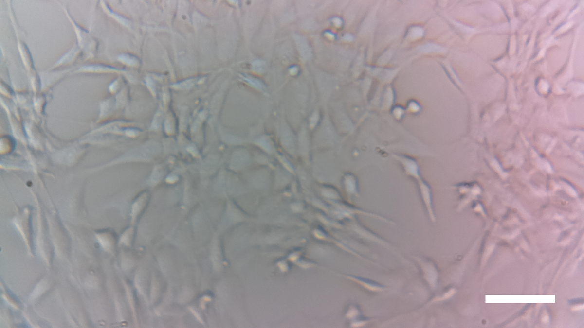 <a href="/Diymicroscope/">Diy microscope</a> scale bar is 200 micrometers