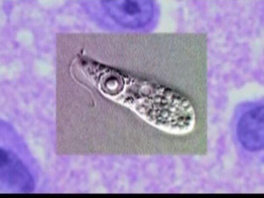 Tennessean's tweet photo. Brain-eating amoeba found in Louisiana water http://t.co/DH9v1nSyaF http://t.co/So1ZwW3Jrz