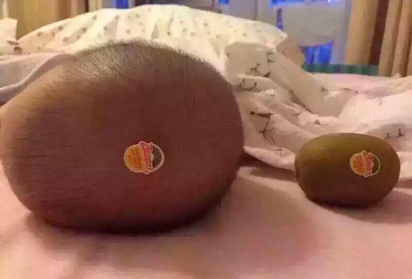 くりお 誰だよ赤ちゃんの頭にキウイのシール貼ったのｗｗｗ どっちがキウイかわかんねえだろｗｗｗ Http T Co Iufq8h0kig Twitter