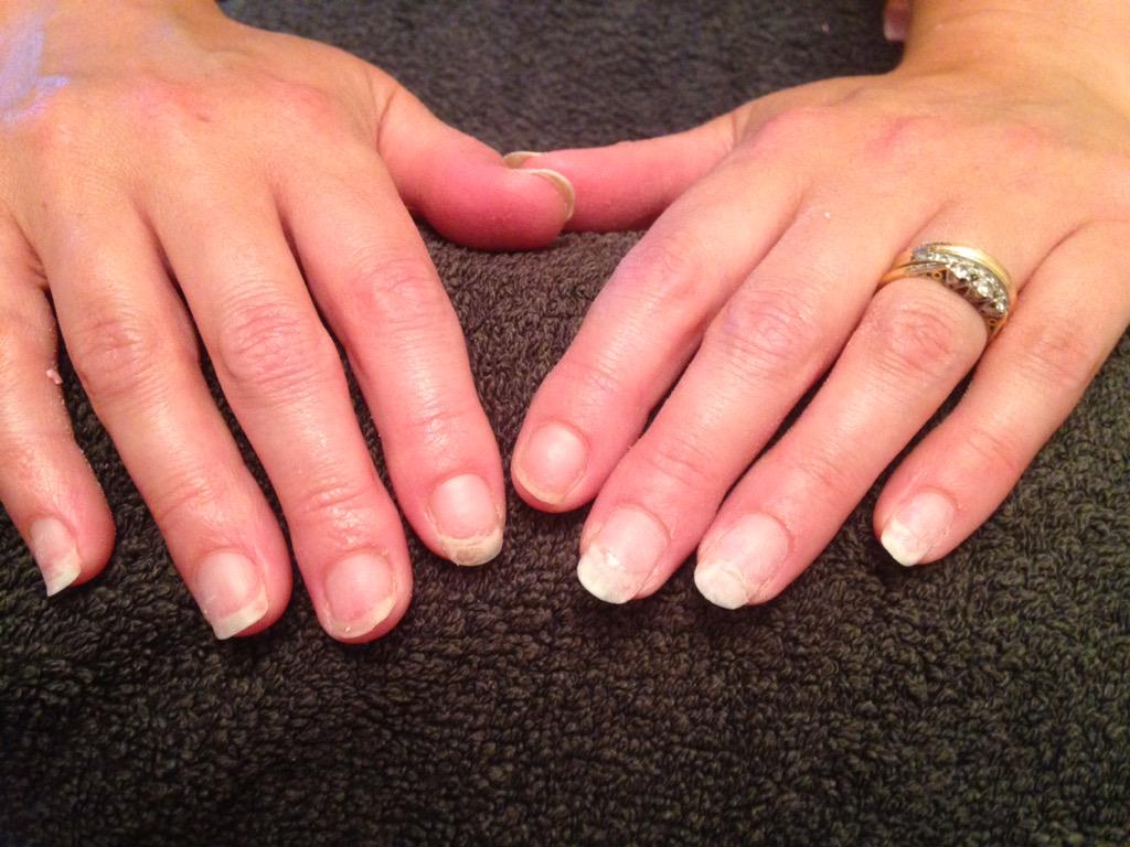 LauraJaneMitch's tweet image. @NailHarmonyUk @Gelish #gelish #beforeandafter #firstappointment #converted #happyclient #makethemgelish #nails
