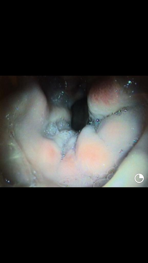 CliffeEquine's tweet photo. Poor performance? Dull coat? Sensitive to girth? Maybe gastric ulceration... Good news? Easily diagnosed and treated http://t.co/ijJb3T5K0w