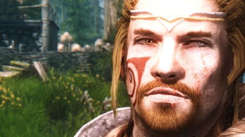 "Ever wanted to know what happened to my eye?"