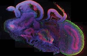 pknoepfler's tweet photo. Fantastic organoid voyage: views from inside a mini-organ http://t.co/tyAWy0P7xU http://t.co/2f9tN8OKT5