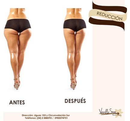 vanillaspa_'s tweet photo. ¡Pierde medidas y remodela tu silueta en pocas semanas sólo en #VanillaSpa! Agenda una cita y transforma tu cuerpo http://t.co/bvKErEogXo