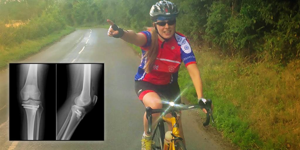 Knee screws out 3 weeks ago, bring it on! #ThisGirlCan #RideLondon <a href="/GISTSupportUK/">GIST Cancer UK - formerly GIST Support UK</a> PLS DONATE! uk.virginmoneygiving.com/team/BassettsA…