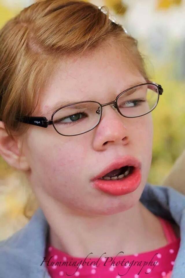 Rachael: 1st in MN to receive new device for severe seizures. <a href="/ChildrensMN/">Children's Minnesota</a>, 1st to offer #aspireSR.  <a href="/kare11/">KARE 11</a> at 6.