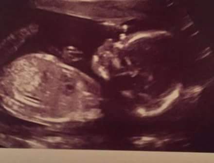 daaliaanatalie's tweet image. My brother and @tooraadforya_45 are having a baby girl!! I'm so excited #firstniece 😍💞👶