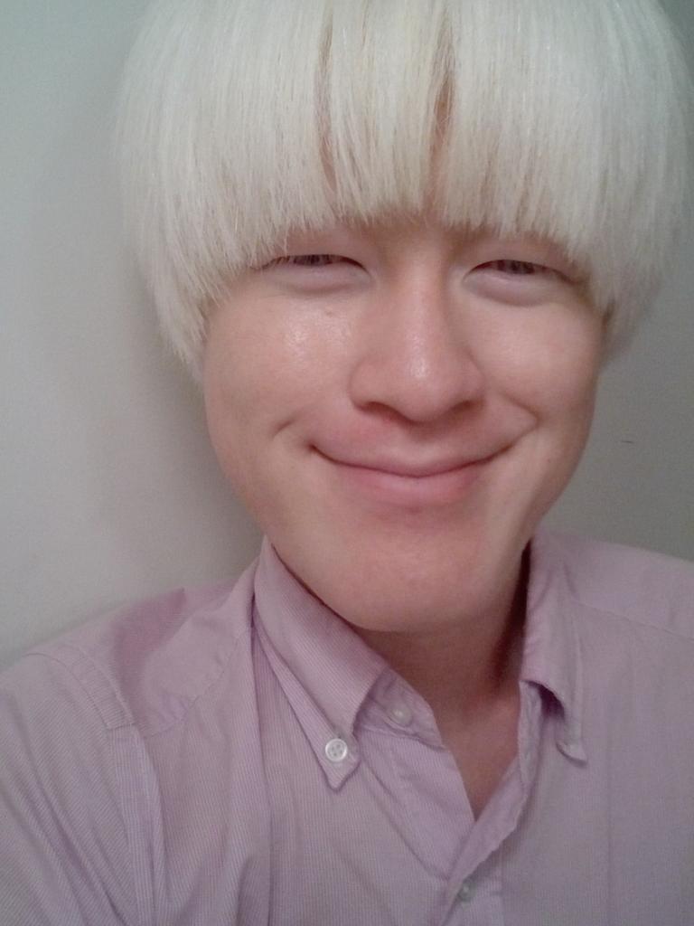 粕谷幸司 Koji Kasuya アルビノ いまこんなかんじ きのこ 丸い 30代 独身 アルビノ Albinism 日本人 夏 ヘアスタイル モデル 粕谷幸司 エンターテイナー Http T Co 2gkwmq8ndg