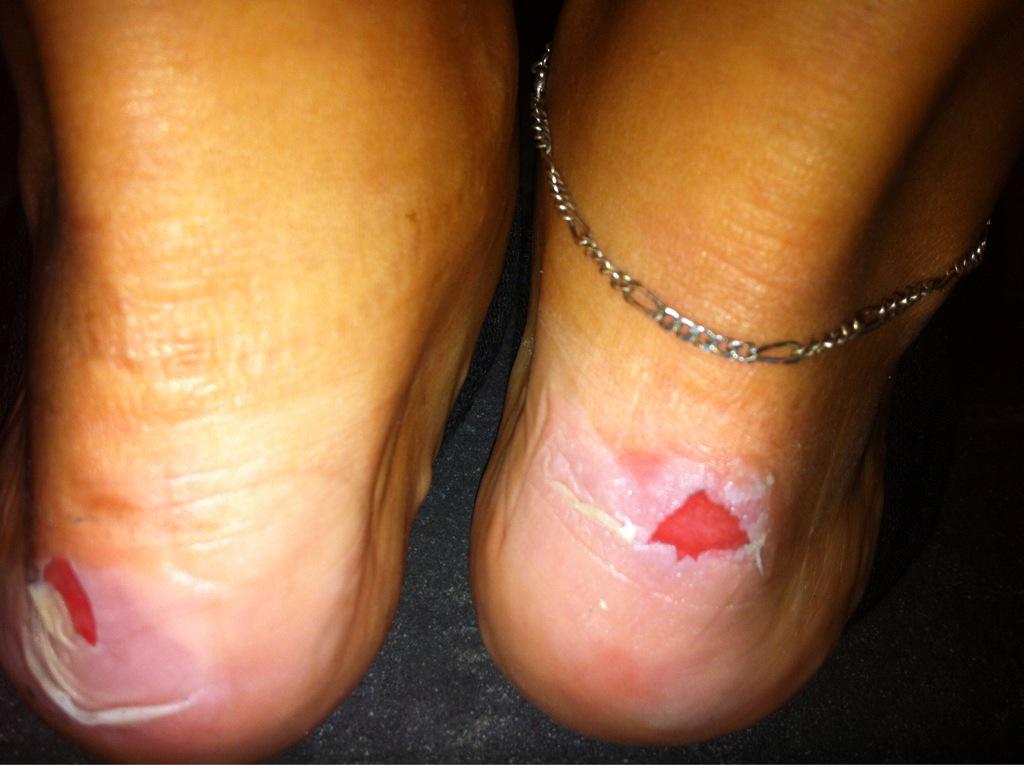 Resultao de trabajar tanto.... #muerodedolor #Planzer