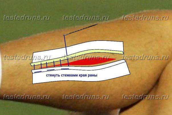 Минобороны закупит фуражек и топографических карт на 2,8 миллиона - Цензор.НЕТ 8524