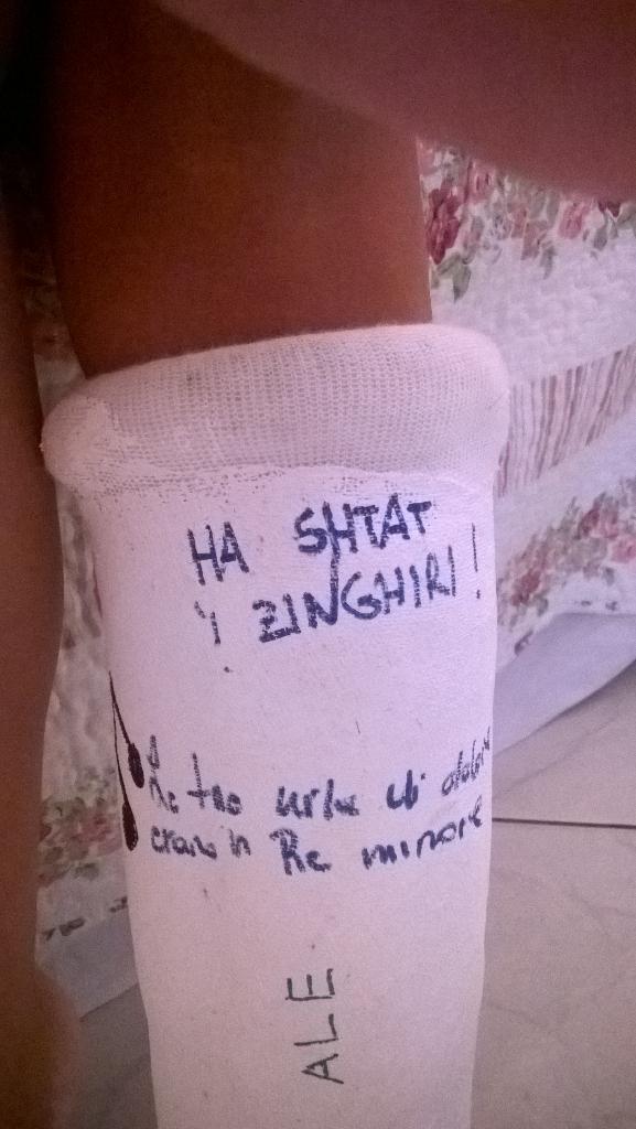 CreazPuppidu's tweet photo. @marciocapatonda ti rompi un piede e ti ritrovi che hanno stato i zinghiri! http://t.co/KRXEpKcAOx