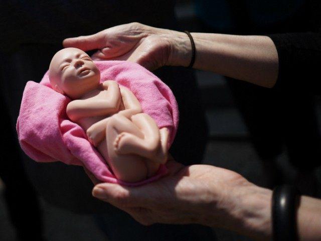 StemExpress bought whole intact dead babies from Planned Parenthood