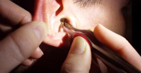 WhatDidlJustSee's tweet photo. She Starts Cleaning His Ear and Then THIS Comes Out!

See here: http://t.co/MZe9UKEc2z http://t.co/A0kf47XXVL