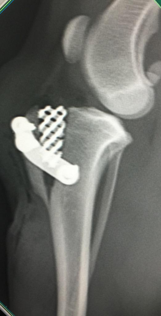 acanadillas1's tweet photo. #poroustta en #perro de 9 kg con cuña de titanio de 6.5 mm y placa y tornillos de titanio del ITC con @atraumaticvet http://t.co/cOJCbvggrl