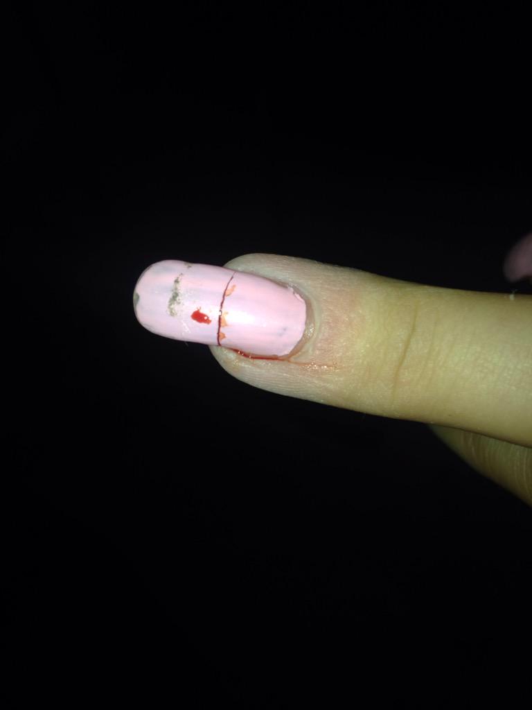 leafarrell's tweet image. Ouch😖