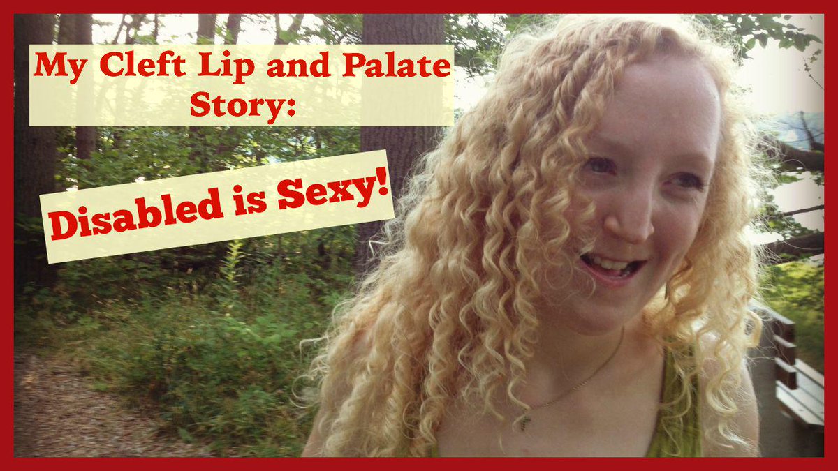 sexydisability's tweet photo. Disabled is sexy! Watch my video http://t.co/pce7US6ipK #cleftstrong #disability #disabled #sexy #cleftlip http://t.co/ZGOpVuGt65