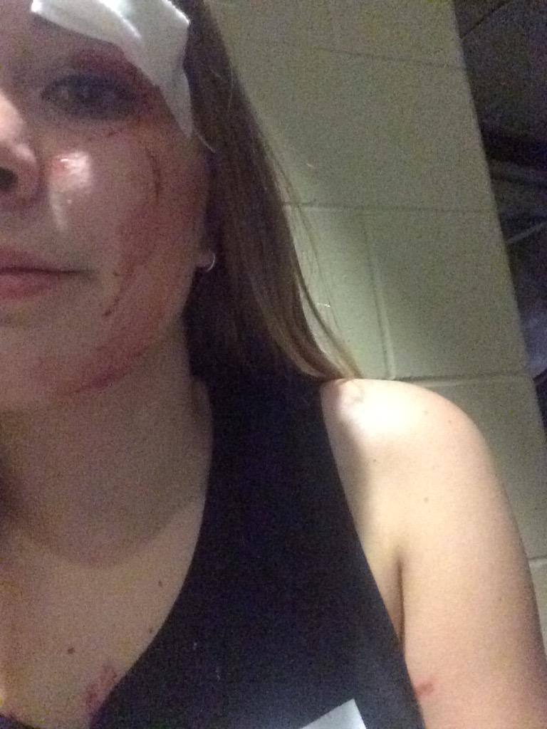 madswaters's tweet image. When you get hit in the face with Ashton's drumstick @Ashton5SOS