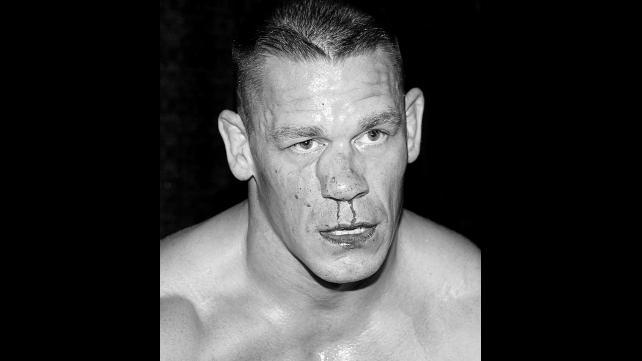 wearewrestling's tweet photo. First Post Surgery Photo Of John Cena’s Nose - http://t.co/zExx2Yh8Mw #JohnCena #WAWNation http://t.co/5htmvQNSHc