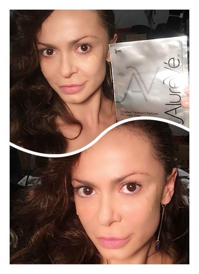 WinningSkin's tweet photo. @DWTSGossip  Want the #AlureVe Eye Patches.  @Karina_Smirnoff ♥️ them. Go to http://t.co/fe6SxqFpzv @WinningSkin http://t.co/Vq0STmUlZF