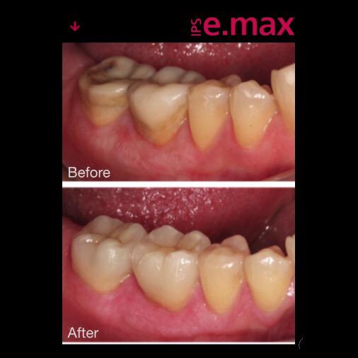 soubt's tweet photo. Smile to the max 2, source smile to the max. #emax, #ipsemax http://t.co/rIhXflIPqF