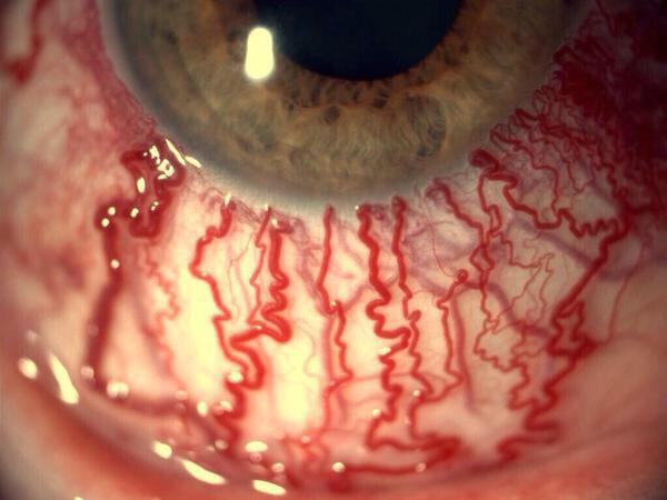 Elparaguayo1231's tweet photo. Una foto de cerca de tu ojo cuando fumas http://t.co/VefNF9Kt3V