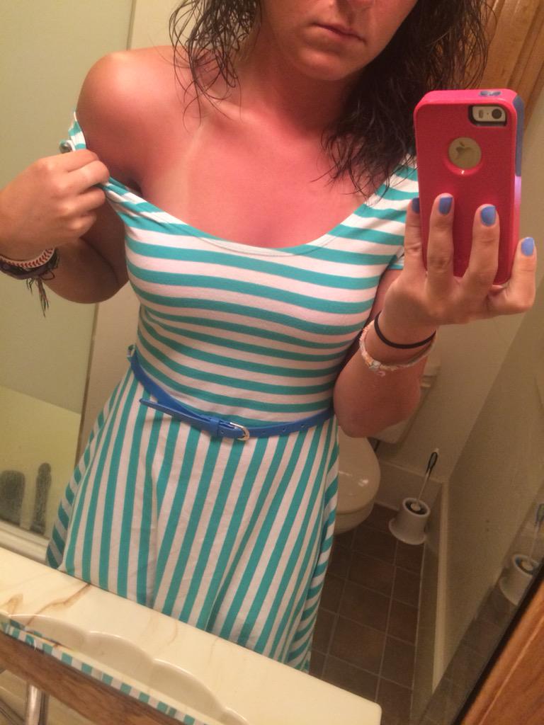 _AddyTurner's tweet photo. I wonder how many unoriginal sunburn jokes I'll hear from customers today. #tellerprobs @TellerStruggle http://t.co/y0c1Qh0Rvu