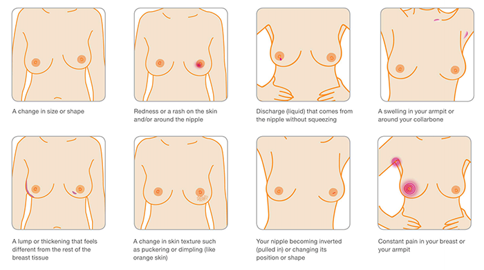 Breast Cancer Now on X: Know 'Em, Love 'Em, Check Your Breasts