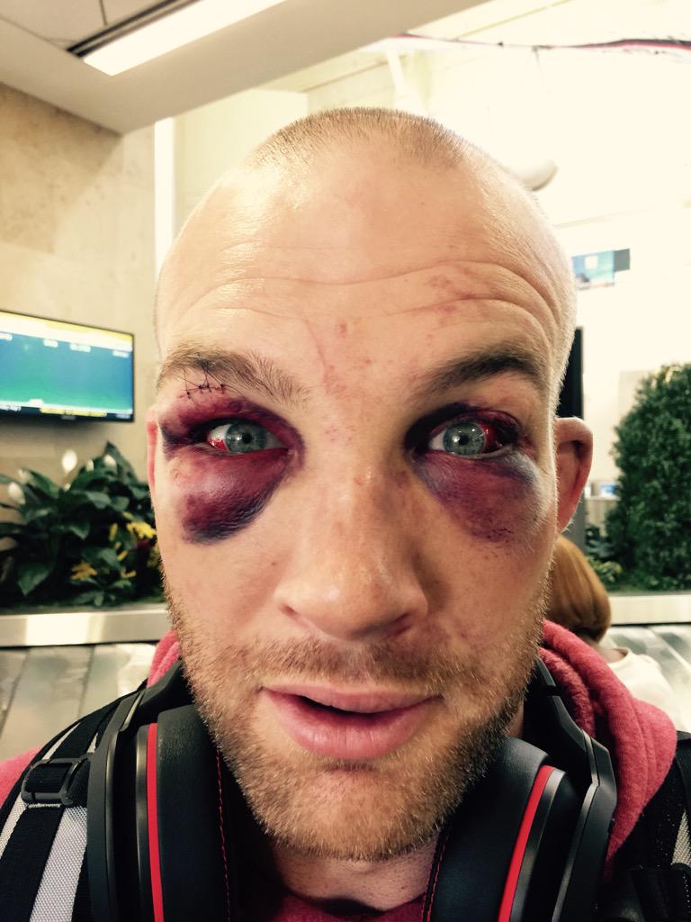 ChaelSonnen's tweet image. My Teammate @OfficialDurkin just had this pic rejected by Tinder..
BADGUYINC.com