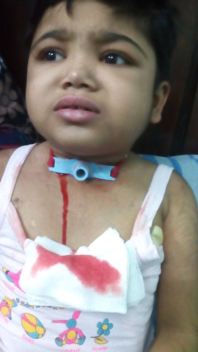 "Now, this vocal tube bleeds. It hurts me so much!," Elsa cries.