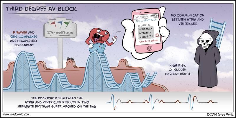 DW8674's tweet photo. #nursingsummerschool - 3rd Degree Heart Block @BedsNursing http://t.co/urQlBPdLGR
