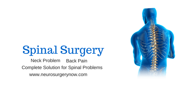 topneurologist's tweet image. Get Best Treatment for #Spinal_Surgery - #Neck_Problem, #Back_Pain 
neurosurgerynow.com