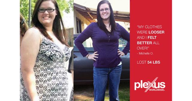 ebeleagu12's tweet image. #whyiplexus