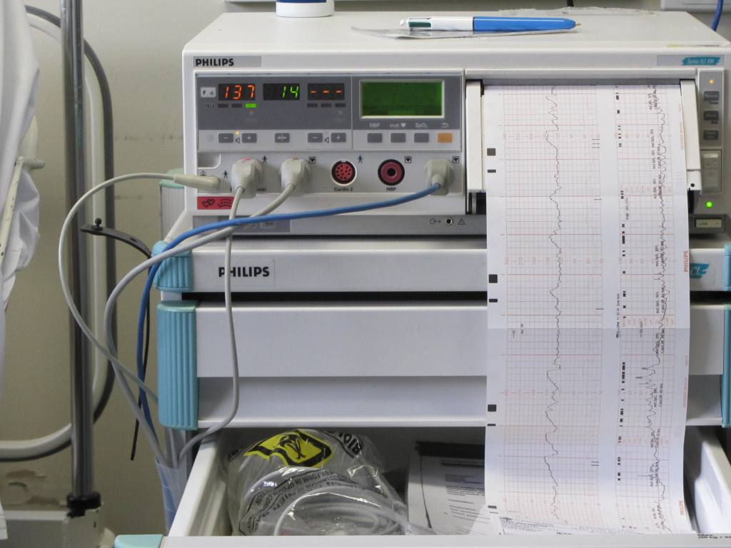 37 weeks readyforparenthood.wordpress.com/2015/08/05/37-…