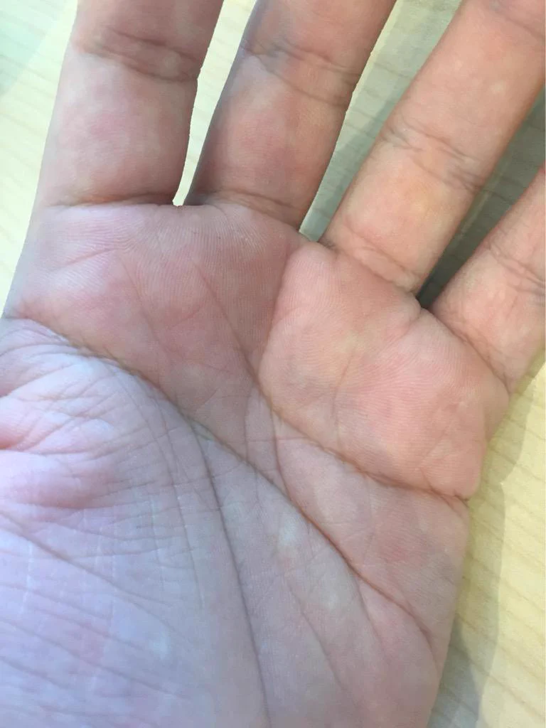 【要確認】あなたにはある？同性愛者に多いニ丁目線ｗｗ