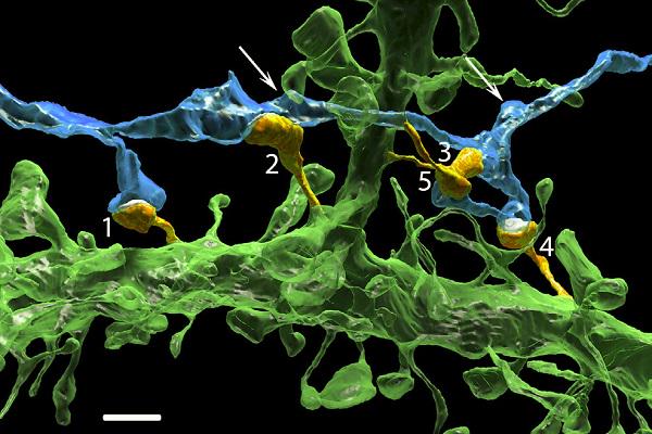science360's tweet photo. A new way to study the #brain. #NSFfunded #research at @BU_Tweets. #science #neuroscience http://t.co/5kBhMNBacZ http://t.co/uzE8G2efeL