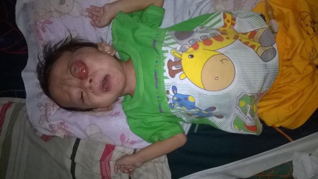 Nyol tolong minta bantuannya buat share. Ananda alfatih umur 1 tahun 2bulan terkena tumor dimata. butuh donasi