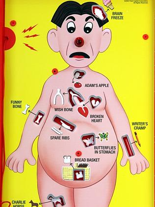 Operation Game (Classic Version Toys Games)