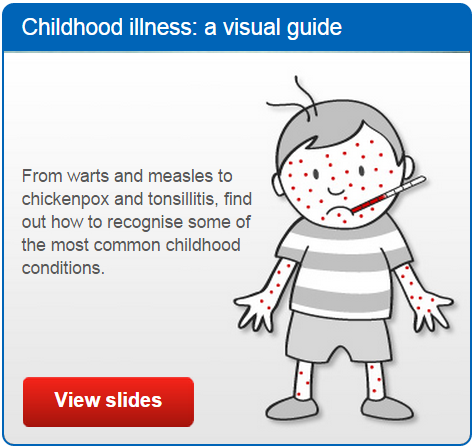 NHSuk's tweet photo. A visual guide to help you identify common conditions and illnesses that may affect children: http://t.co/sCXz2U3uv5 http://t.co/no51Zym4bu