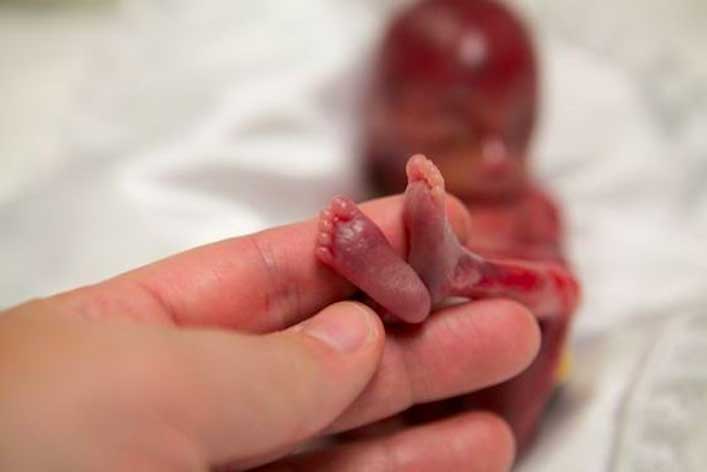 LifeNewsHQ's tweet photo. Amazing New “Pea Pod” Invention Helps Premature Babies Survive http://t.co/bNIY28JK9Q Good Friday #abortion http://t.co/baL3dRyqBx