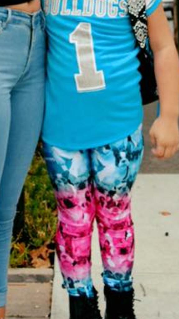 jessicagoff40's tweet photo. WHAT ARE THOSEEEE?!😐😟😫 #NotRelatedToMe http://t.co/PW0v4AHNVC