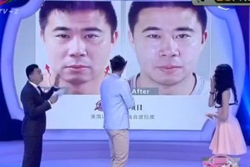 Image result for dong fangzhuo face surgery