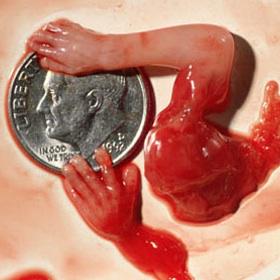 IsaacDavisMA's tweet image. #PlannedParenthood Murders babies #PPSellsBabyParts #DefundPP Be #ProLife #DefundPlannedParenthood #StopHillary