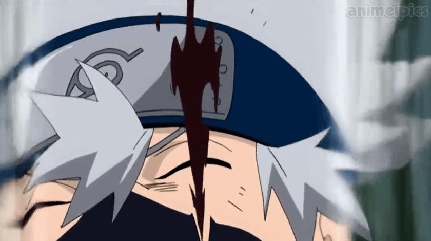 OfficalRAIKAGE's tweet photo. How fetty wap actually fucked up his eye 💀😭😭😭 http://t.co/cSZExIAmxz
