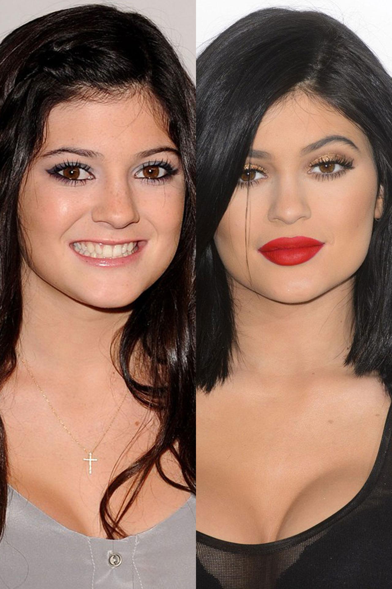 Happy 18th Birthday to Kylie Jenner!   Check out her beauty transformation:  
