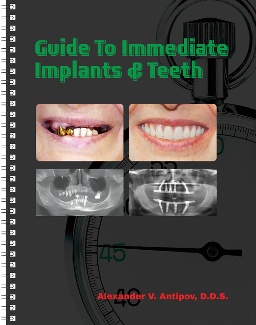 Books published by <a href="/Dr_Antipov/">Dr.Alexander Antipov</a> #dentalimplant #dental #oralsurgery #jawsurgery ebay.to/1KHVFLp
