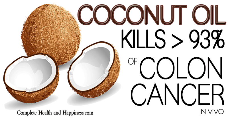GlobalGoodsInc's tweet photo. #CoconutOil Kills 93% of #Coloncancer Cells In Vivo! Find ur extra-virgin coconut oil at http://t.co/G6stkFLqRi! http://t.co/xUqNKGg0GF