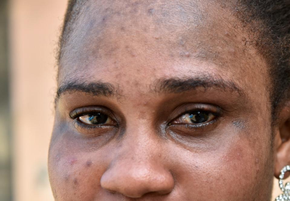 CapitalFMKenya's tweet photo. Chasing fair skin, Ivorians ignore whitening cream ban http://t.co/voNTjPChyB http://t.co/zWSlKsjqNp