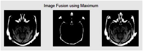 pantechsolution's tweet image. Matlab code for #PixelLevelImageFusion using Maximum Method
bit.ly/1jTiwHR