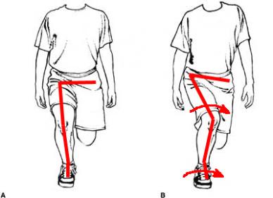 Can Your Hip’s F Get IR? 6 Quick Videos on How to Get IR thenominalistblog.com/2015/08/11/can…