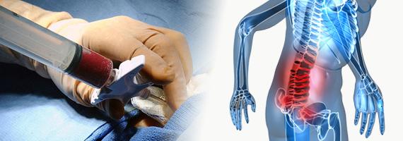 bonemarrowindia's tweet photo. On occasion of #organ transplant day, http://t.co/qzs1zmjlFM are offering low cost #bone marrow #transplant #surgery. http://t.co/GFySwA6W8b